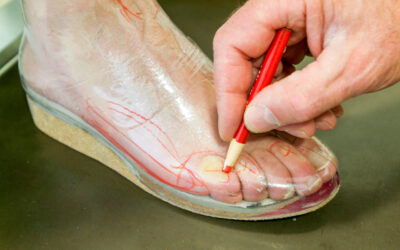 Scarpe ortopediche su misura