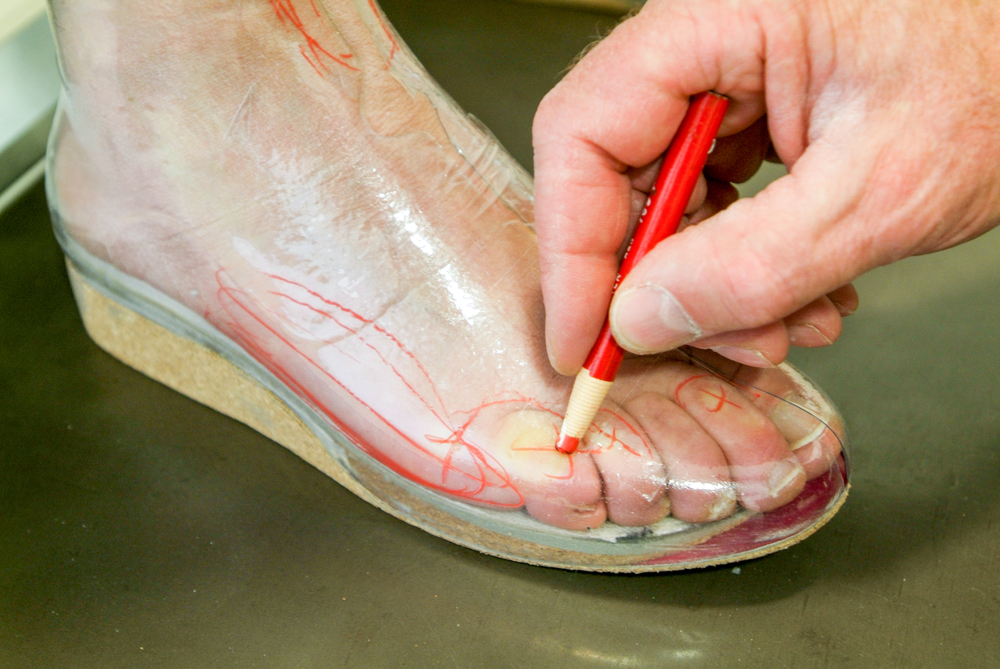 Scarpe ortopediche su misura
